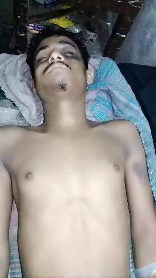 ভোলার বোরহানউদ্দিনে নৃশংস  হত্যাকাণ্ডের কোরআনে হাফেজ শামীম নিহত