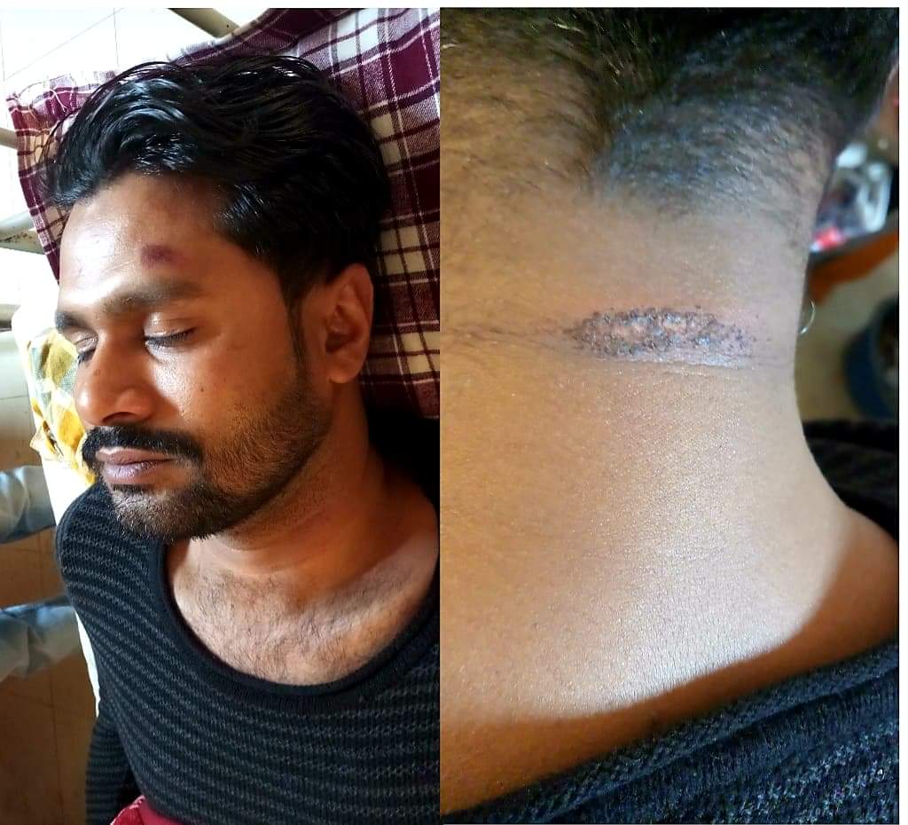 ভোলার চরসামাইয়ায় যুবক কে রাতের আধারে হত্যার চেষ্টার অভিযোগ