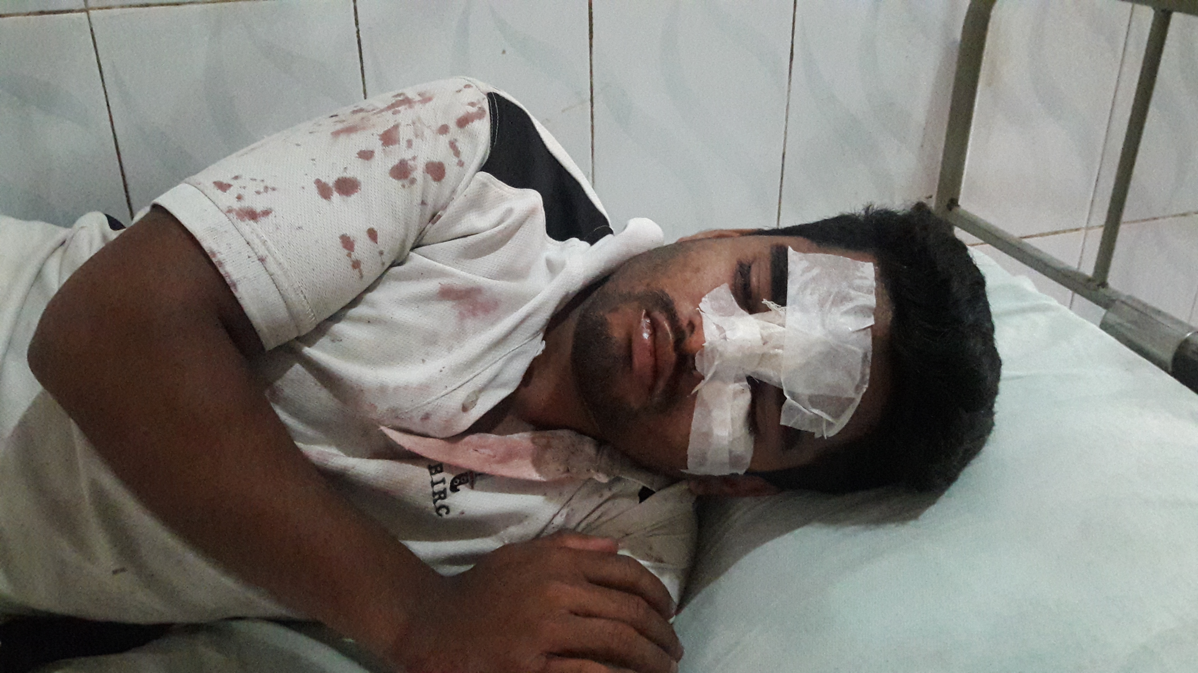 ভোলার চরস্যমাইয়ায় প্রকাশ্য যুবককে হত্যার চেস্টা