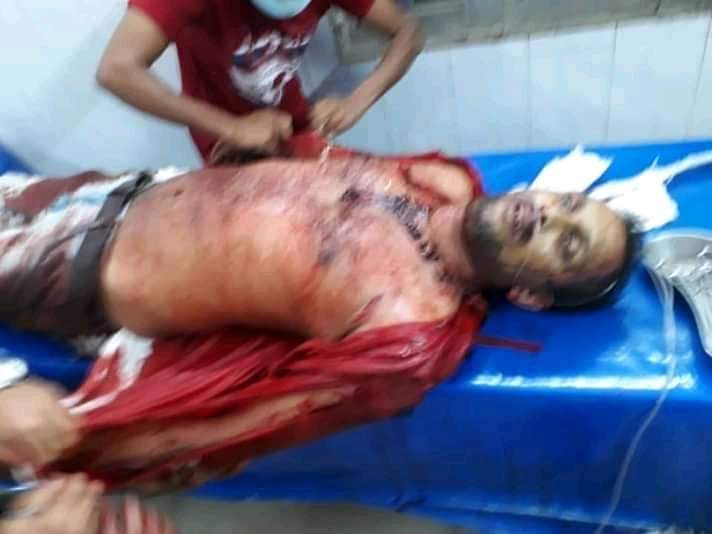 ভোলায় স্বর্ন ঔষুদ ব্যবসীয়কে কুপিয়ে নিহত। আটক ১।।