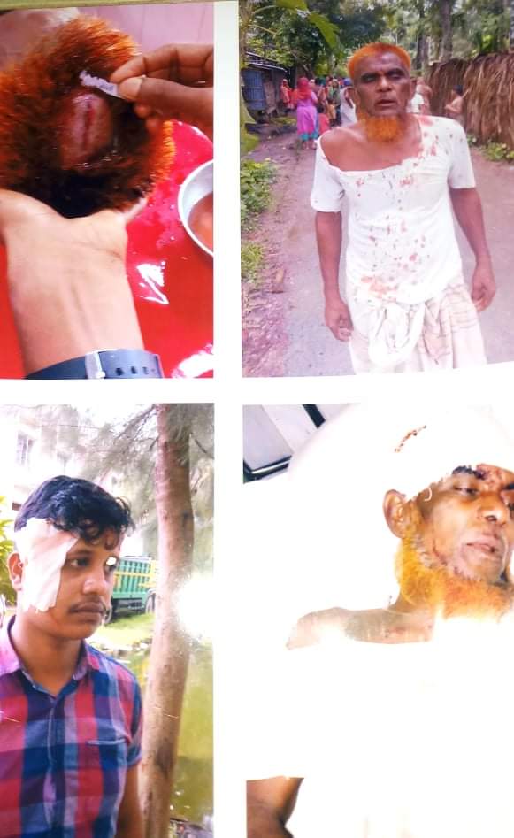 ভোলার বাপ্তায় তুচ্ছ ঘটনাকে কেন্দ্র করে বৃদ্ধা সহ ৪জনকে কুপিয়ে রক্তাক্ত।।