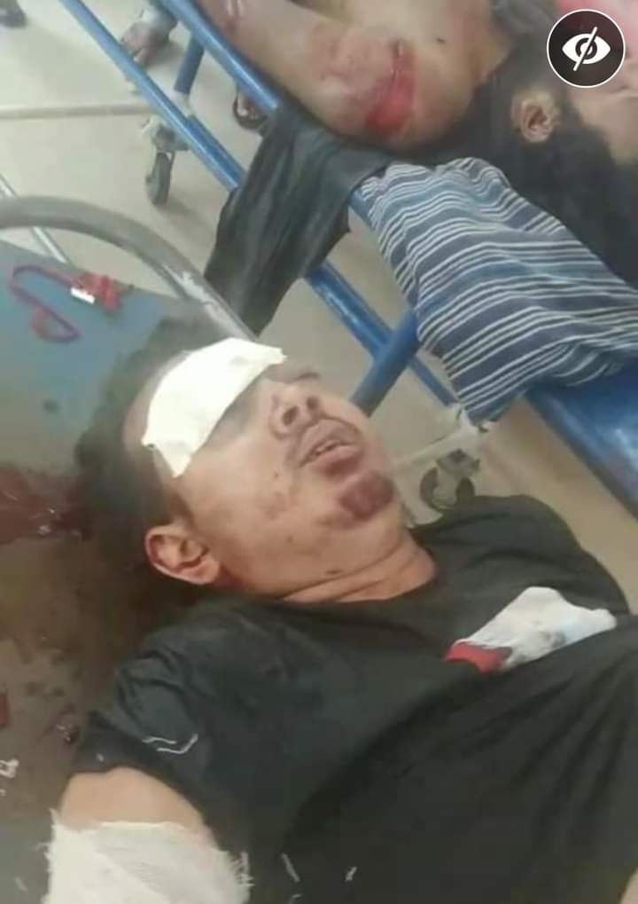ভোলার বাপ্তায় সড়ক দুর্ঘটনায় ঝড়ে গেল দুটি তাঁজা প্রাণ।।