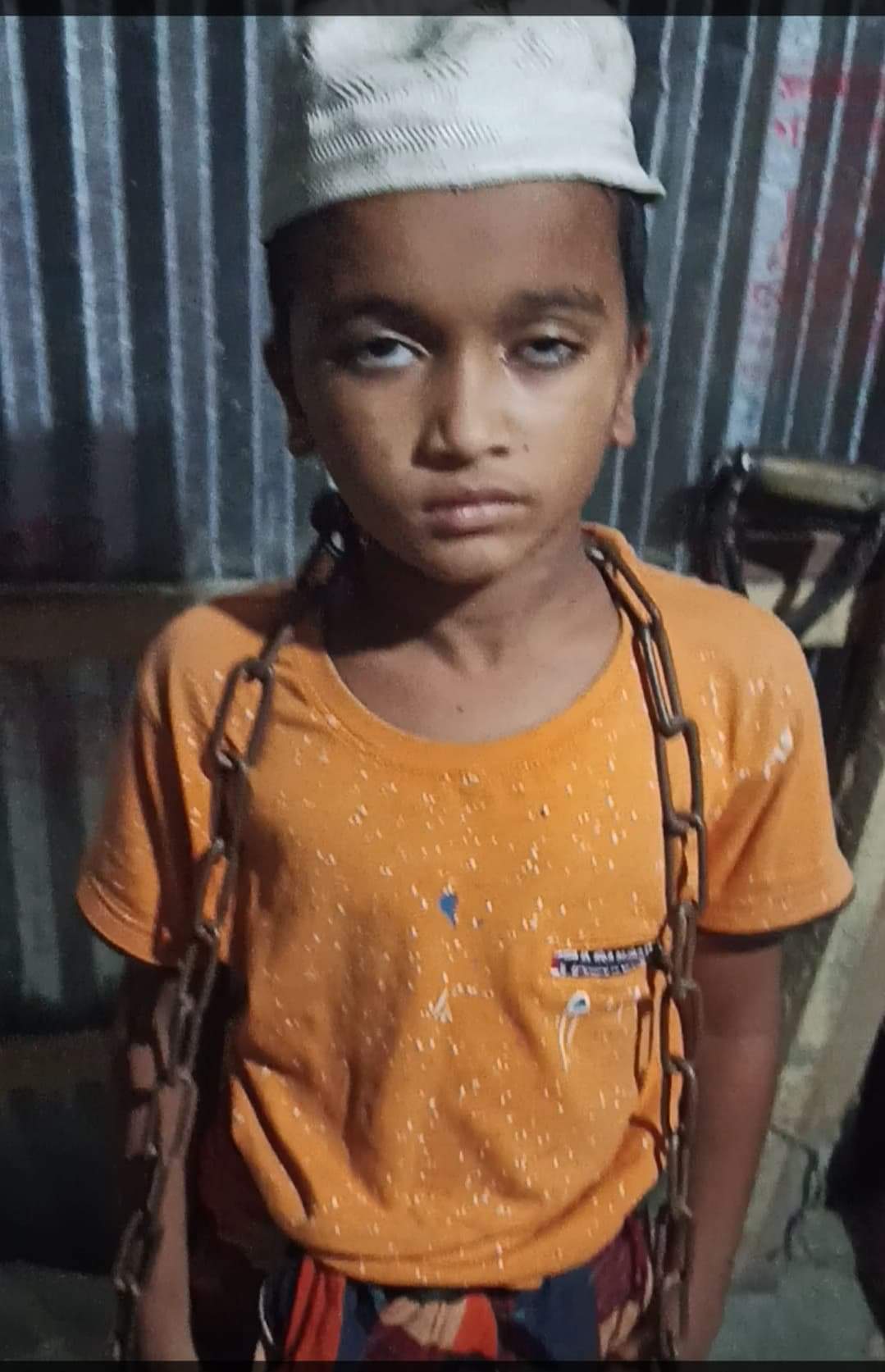 ভোলার বাংলাবাজারে হাফিজিয়া মাদ্রাসায় শিক্ষার্থীদের উপর শিক্ষকদের এ কেমন পাশবিকতা?