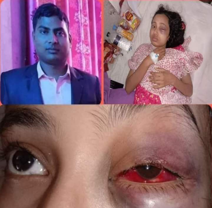 ভোলার বোরহানউদ্দিনের সেই যৌতুক লোভী বিজিবি সদস্য পুলিশের হাতে আটক।।