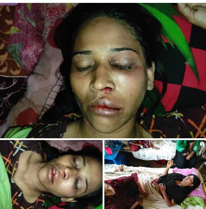 ভোলায় পরকীয়ায় বাঁধা দেয়ায় স্ত্রীকে হত্যার চেষ্টা।।