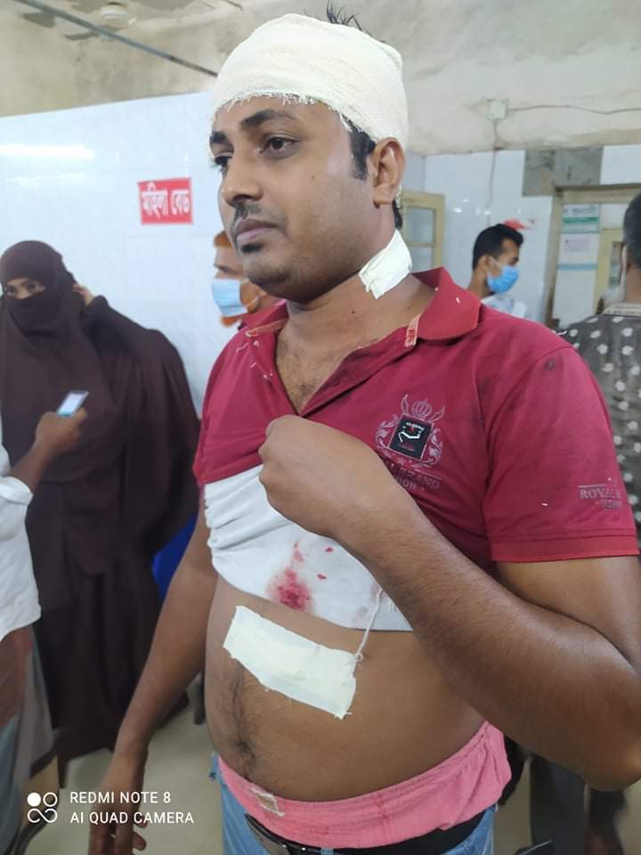 ভোলার রাজাপুরে সাংবাদিক বিল্লাল নাফিজের উপর অতর্কিত সন্ত্রাসী হামলা।।