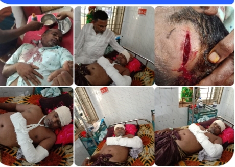 ভোলার রাজাপুরে আ’লীগ সভাপতি কে কুপিয়ে জখম করেছে মেম্বার সালাম