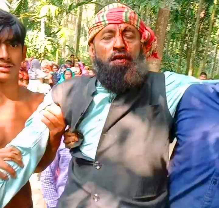 ভোলার পশ্চিম ইলিশায় চেয়ারম্যান এর বাড়িতে ডুকে অর্তকিতভাবে সন্ত্রাসী হামলা।।