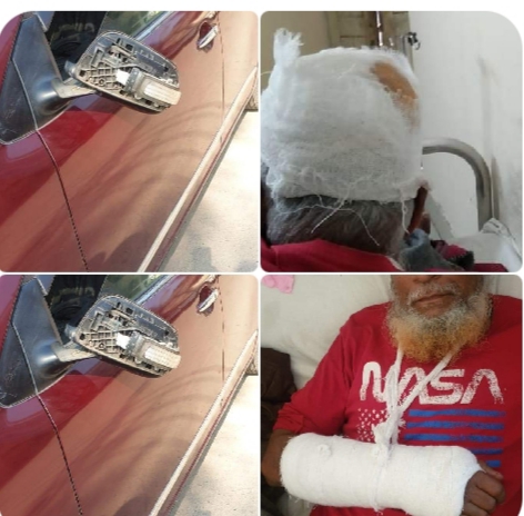 ভেলুমিয়ায় চেয়ারম্যান পরিবারের উপর অর্তকির্ত সন্ত্রাসী হামলা ও গাঁড়ি ভাঙচুরের অভিযোগ।।