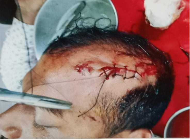 ভোলায় মাদকের প্রতিবাদ করায় যুবককে কুপিয়ে জখম করছে দূর্বৃত্তরা।।