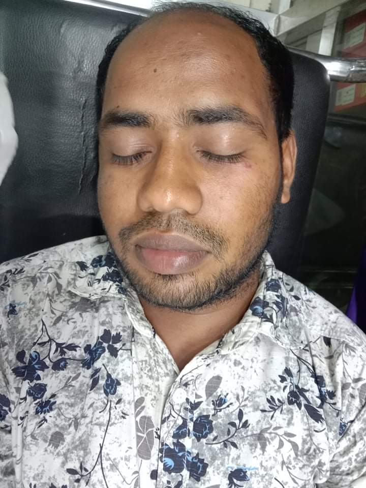 ভোলার নতুন বাজারে ব্যবাসায়ীর উপর সন্ত্রাসী ইয়ামিনের হামলা টাকা ও মোবাইল ছিনতাই।।