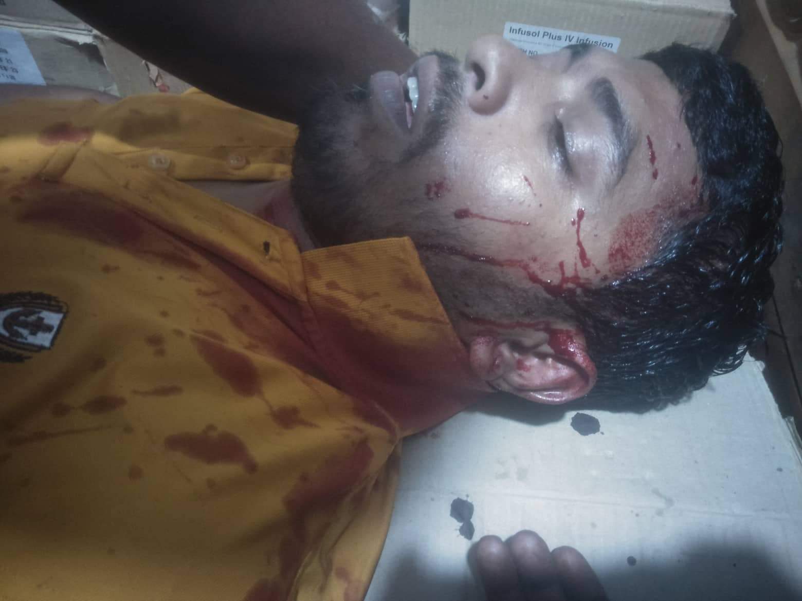 ভোলার ভেলুমিয়ায় পূর্ব শত্রুতার জের ধরে কুপিয়ে জখম।।