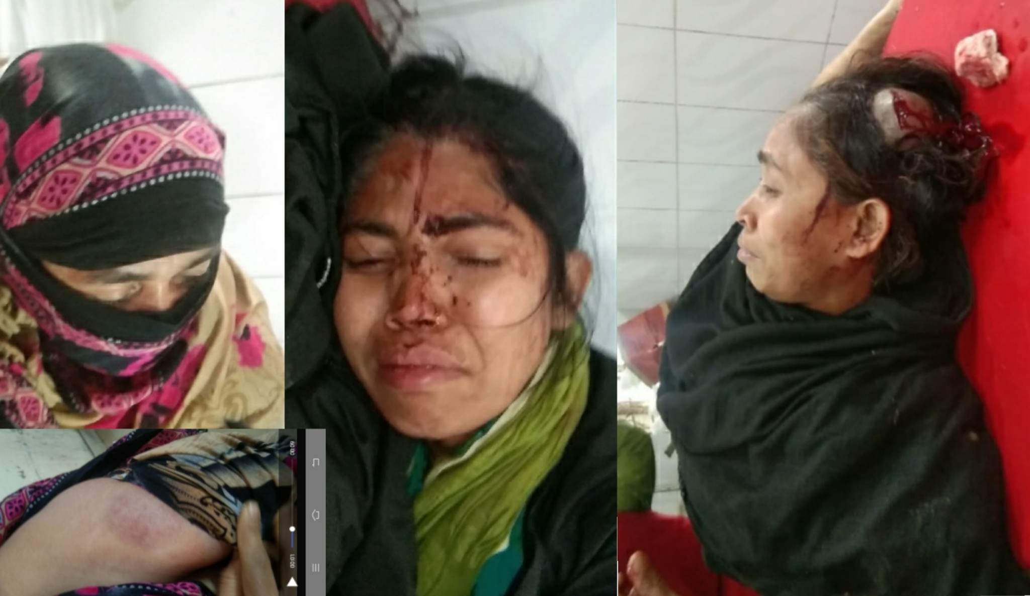 বিজয়ের মাসে ও মুক্তিযোদ্ধা পরিবারের ওপর হামলা,আহত-৩।।