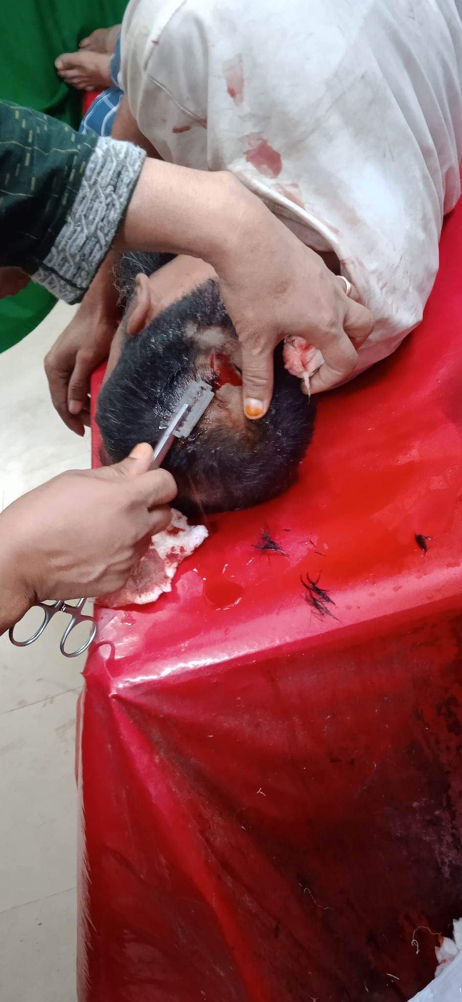 ভোলার চরসামাইয়ায় গাঁড়ির চালককে কুপিয়ে জখম।।